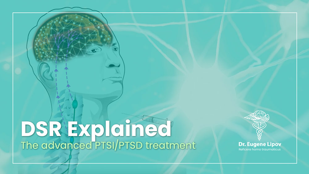 VIDEO THUMBNAIL IMAGE: In under 90 seconds, an overview of treatment to the stellate ganglion (SGB/DSR) is presented, a methodology developed by Dr. Eugene Lipov.